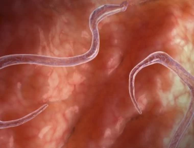 Παράσιτα στο έντερο: Έτσι θα τα καταλάβετε